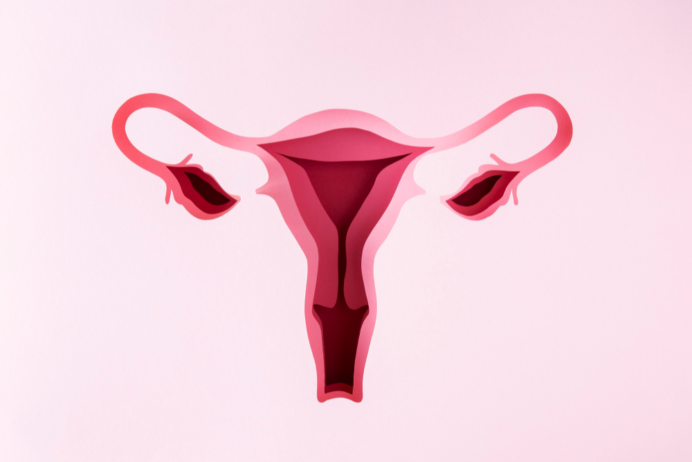 Endometrial Polip